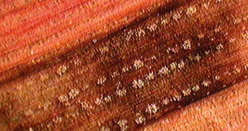 La sénescence des feuilles touchées est très rapide. Si l’observation à la loupe du dessous des feuilles desséchées révèle des alignements de points blancs, le diagnostic de ramulariose est confirmé.